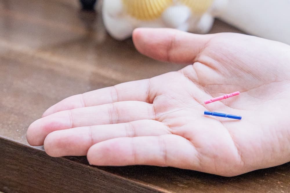 マタニティ鍼灸